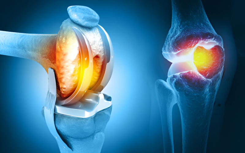 Minimally Invasive Orthopedic
