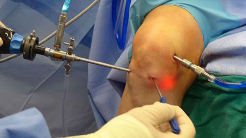 Minimally Invasive Orthopedic