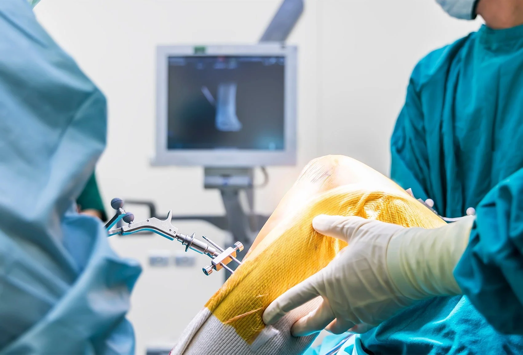 Minimally Invasive Orthopedic